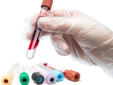 Proba de sangue para parasitos
