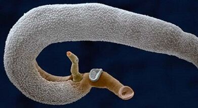 Que parasitos poden vivir nun estómago humano