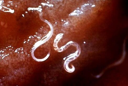 parasitos dentro do corpo