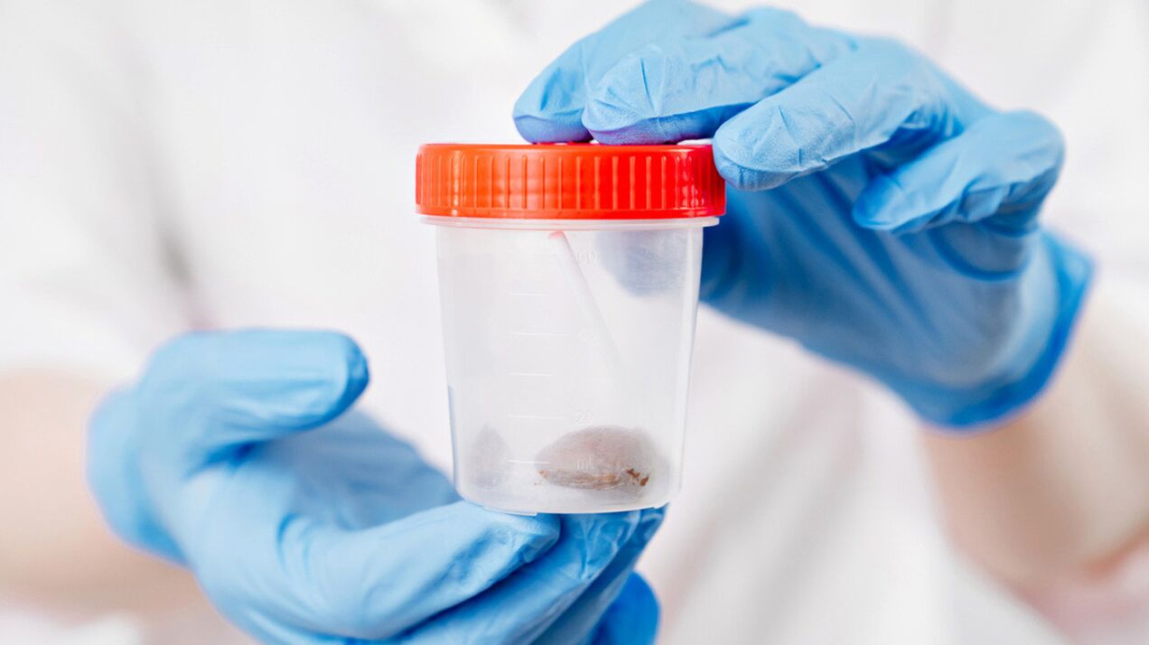 A proba máis sinxela que mostra a presenza de vermes é unha proba de feces.