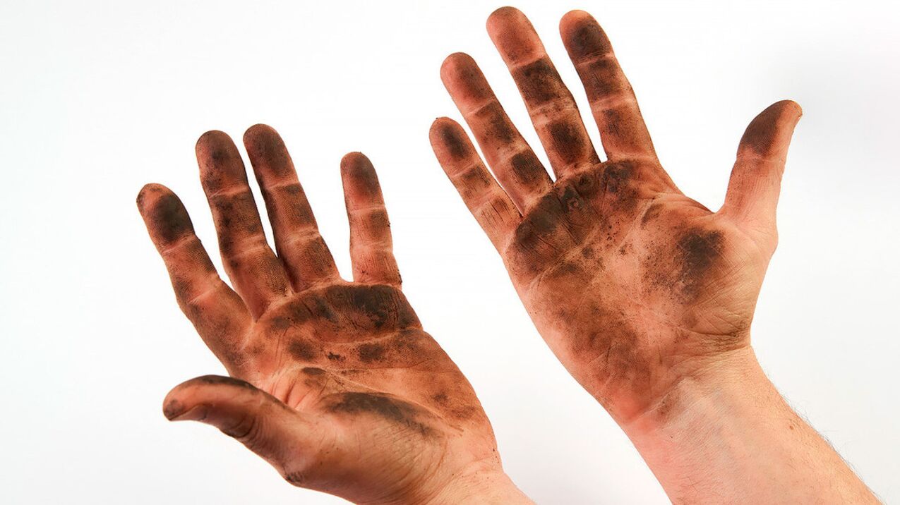 Os que abusan das normas de hixiene e non se lavan as mans corren o risco de contraer vermes