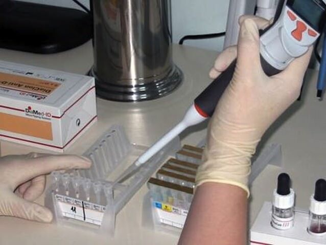 Probas de laboratorio para diagnosticar enfermidades parasitarias